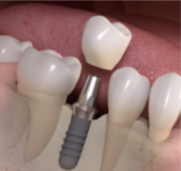 歯医者の選び方